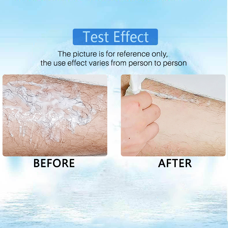 🔥 Magic Hair Removal & Hair Inhibitor【Buy 5+ Get Extra 25% OFF】