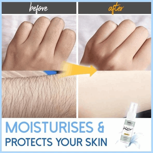 (🔥Summer Hot Sale 50% OFF) Semi-permanent Hair Removal Spray - BUY 4 FREE SHIPPING