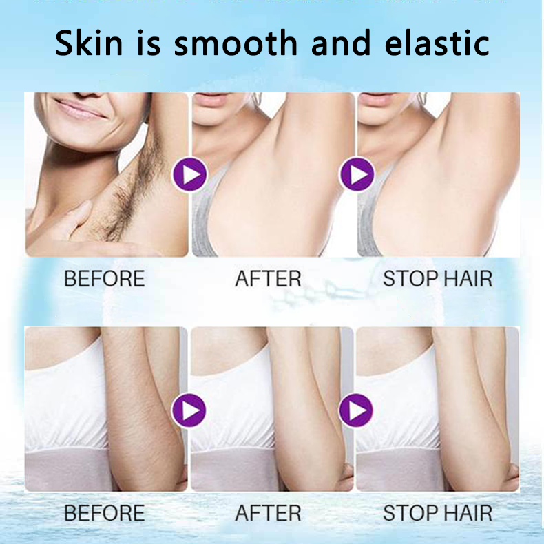 🔥 Magic Hair Removal & Hair Inhibitor【Buy 5+ Get Extra 25% OFF】