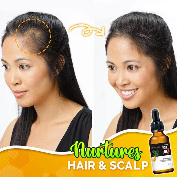 10X-Regro Strong Hair Serum - 💯BUY MORE SAVE MORE💯
