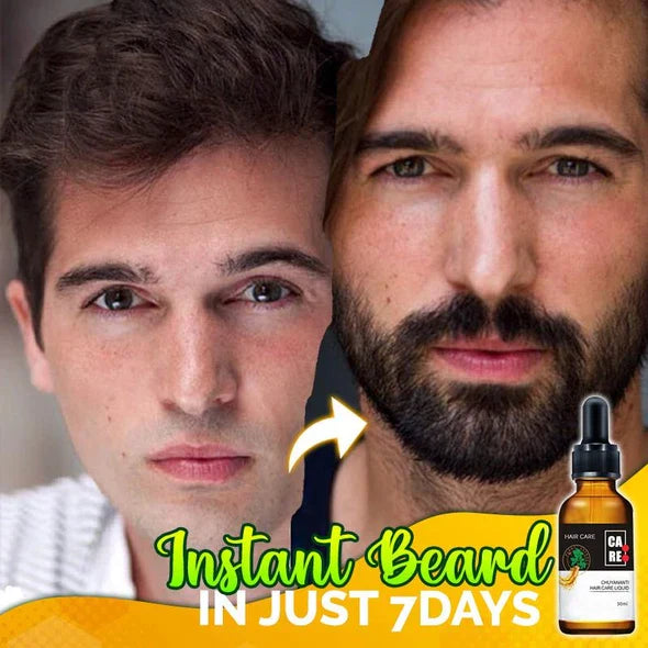 10X-Regro Strong Hair Serum - 💯BUY MORE SAVE MORE💯